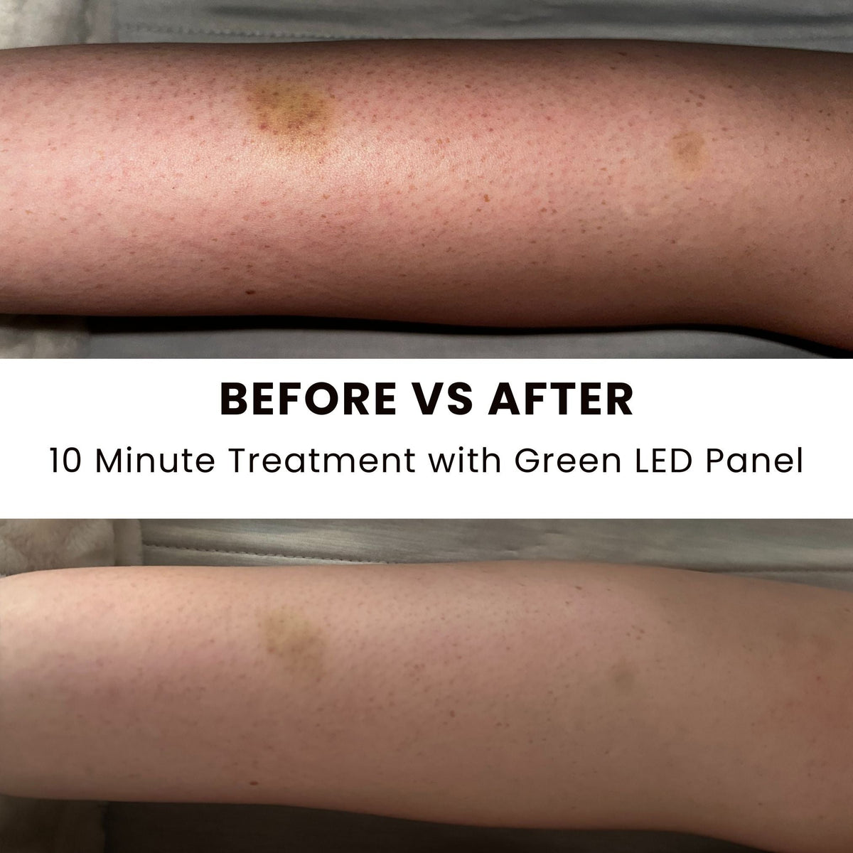 Lumara Illuminate Green V1 Green Light Therapy Panel