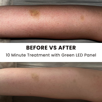 Lumara Illuminate Green V1 Green Light Therapy Panel